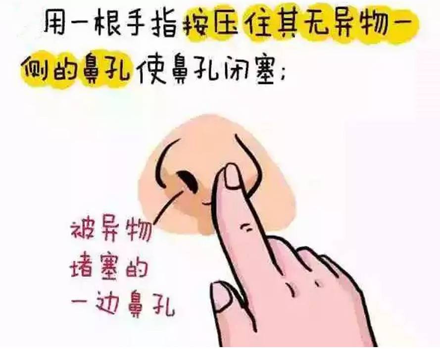 4岁男孩把黄豆塞进耳朵,小男孩把豆子塞耳朵里了