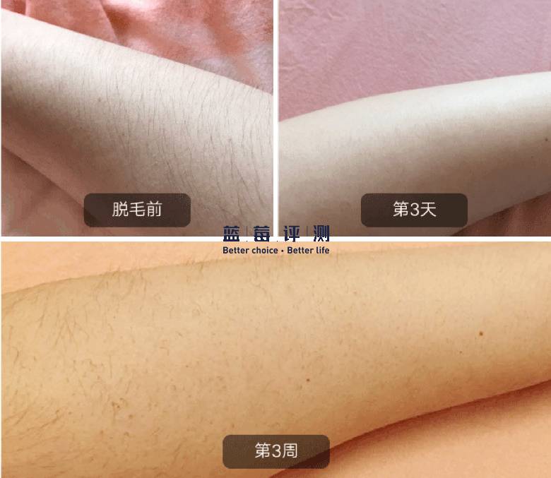 有哪些比较好用的美容仪可以推荐,最好用的有效的美容仪