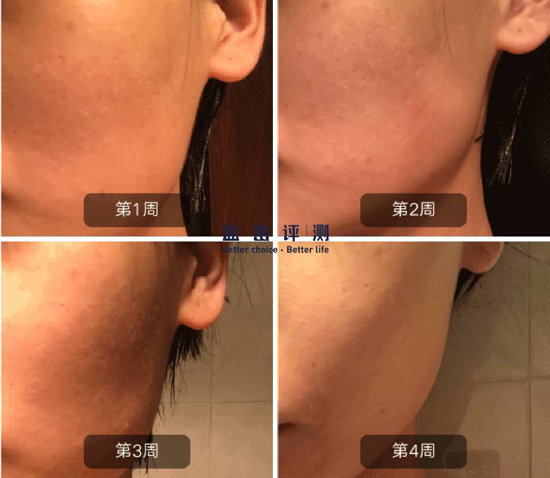 十大公认最好的美容仪,公认最好的美容仪推荐一下