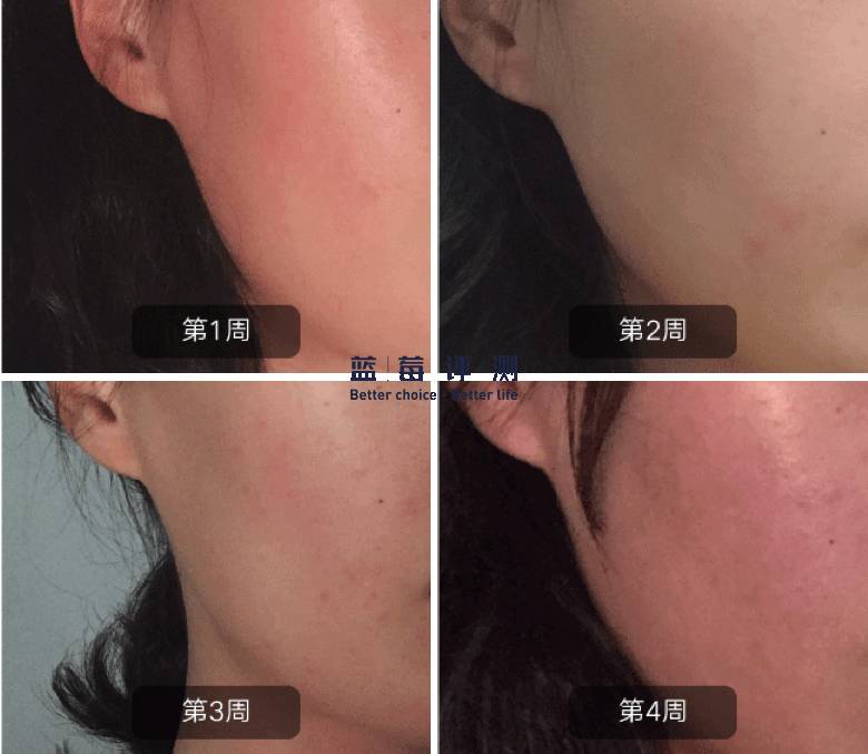 有哪些比较好用的美容仪可以推荐,最好用的有效的美容仪