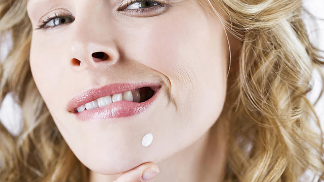 多年的痘痘被彻彻底底解决,困扰多年的痘痘终于好了