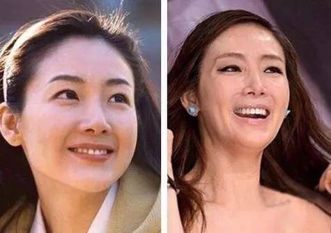 过了25岁的你,过了25岁就开始用抗皱护肤品吗