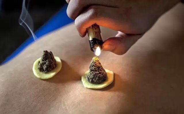 一叶知秋，雪中送炭话艾灸