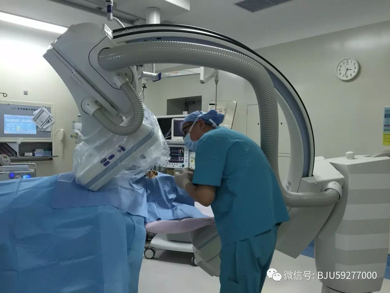 微球囊压迫术治疗三叉神经痛成都,射频热凝治疗三叉神经痛几天出院