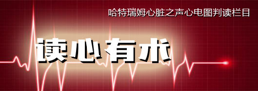 读心有术216,读心有术236期