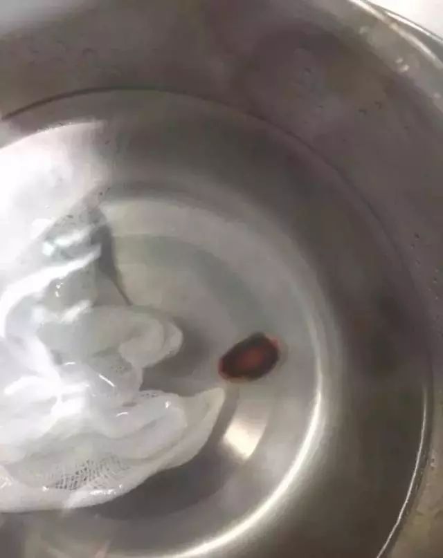 5岁小孩咳嗽了两个月了总是不好,6岁女童咳嗽要如何治疗