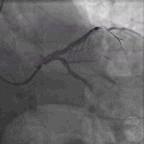 典型病例及处理方法,典型病例分析及治疗方法