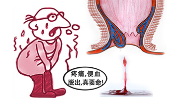 便秘拉屎出血怎么办,孕期便秘出血怎么办