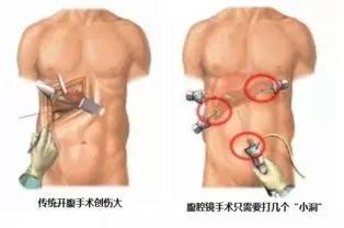 老人80几岁肚子发烧怎么回事,80多岁老人卧床发烧39度多吃什么