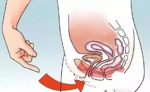 你有漏尿的尴尬吗？跟我学做凯格尔运动吧！