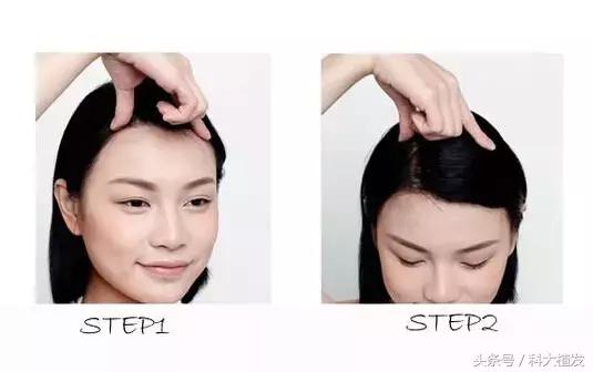 用脑过度导致头部紧绷,头皮松弛对大脑有影响吗