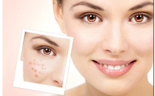 割双眼皮之后哭了会疤痕增生吗,割双眼皮后需要买疤痕药膏吗