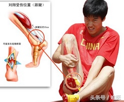 跟腱炎是不是要放弃运动了,得跟腱炎就是废了吗