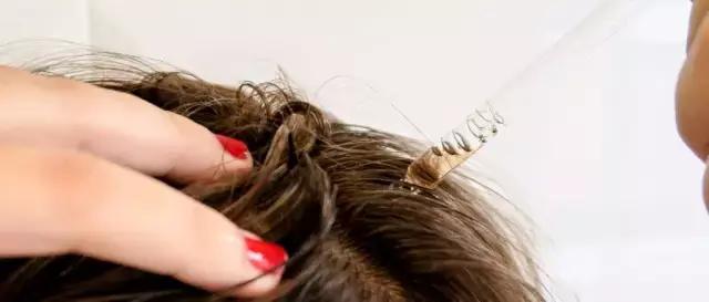 突然大把大把掉头发是怎么回事,超多头发怎么办