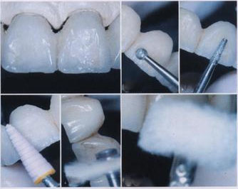 虎齿太长了可以磨短吗,虎齿可以磨平吗