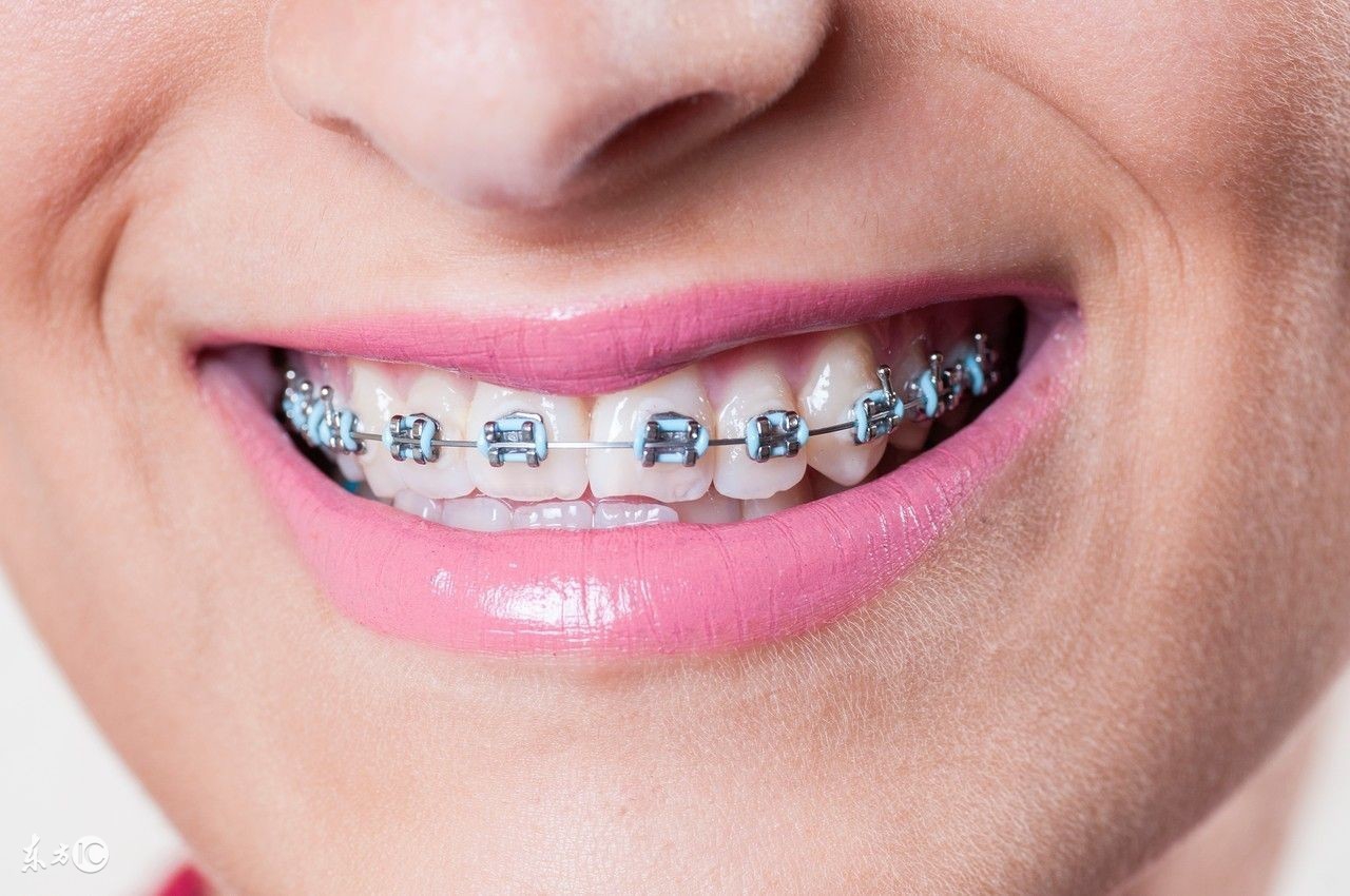 牙齿矫正是调整咬合难还是收缝难,牙齿咬合整齐但有点龅牙