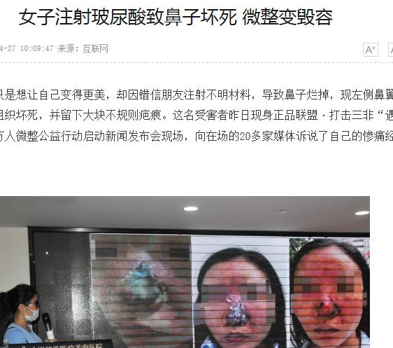 娱乐圈不老小妖精们的诀窍，玻尿酸的一二事儿~