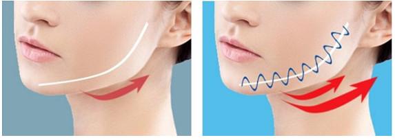 为什么做完蛋白矫正发尾会翘,为什么做完蛋白矫正会头痒