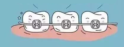 网上买牙套矫正牙齿靠谱吗,拼多多的牙套能矫正牙齿吗