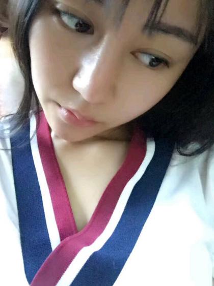 植发手术后一劳永逸了,植发做了两次以后还有毛囊可做吗