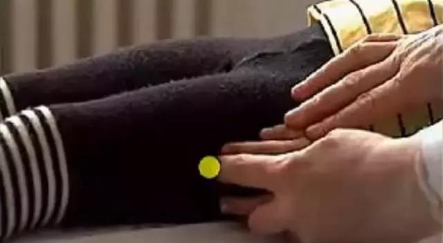孩子湿疹怕用药有激素,不妨试试这几个穴位