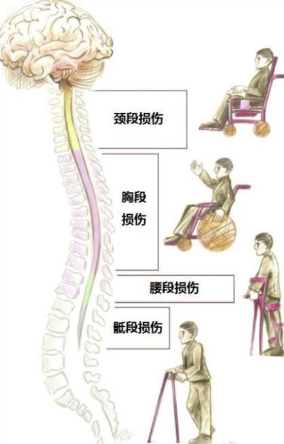 自然灾害的名称及自救自护方法,面对自然灾害应掌握哪些自救技能