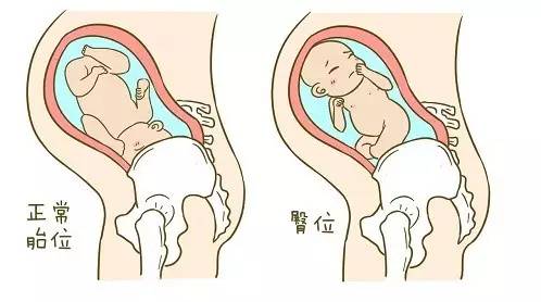 孕前期见红中后期需要注意什么,孕中后期注意事项