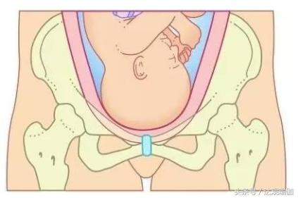 产后妈妈为什么需要做产后修复,瑜伽产后修复和美容院产后修复