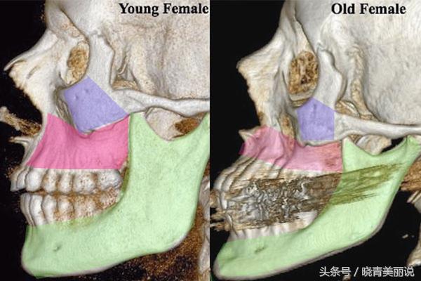 孩子刚出生就有法令纹,15岁小孩为啥有法令纹