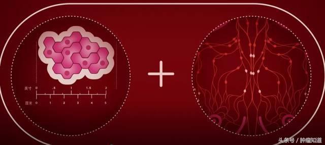 3阴性乳腺癌2期能治好吗,乳腺癌3期a是什么意思