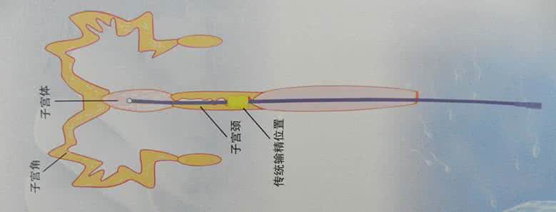 母猪深部输精优缺点,母猪深部输精多久一次