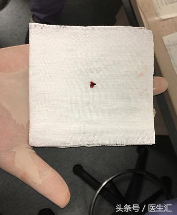 80岁老人突然脑梗塞,80岁老人脑梗塞怎么治