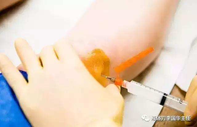 强直性脊柱炎不可告人的秘密,关于强直性脊柱炎的六大误解