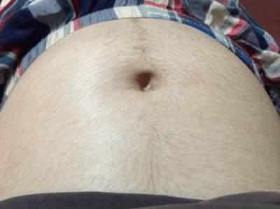 孕期长毛生完会消失吗？宝宝会多毛吗？长毛跟生男生女有关系？