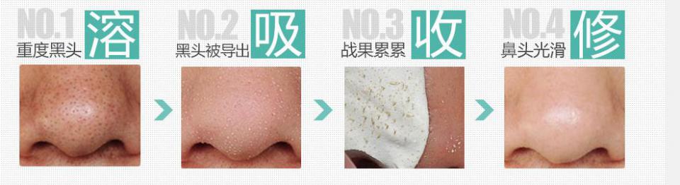 毛孔管理哪里可以做,毛孔管理臻美