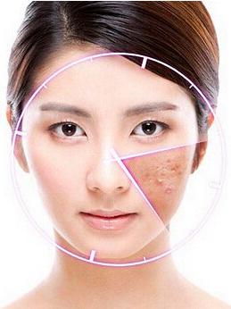 女子长出胡子,女子居然长出胡子