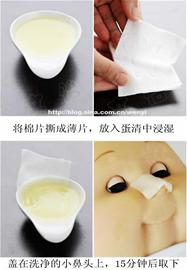 鸡蛋清去黑头效果真的那么神奇吗,用鸡蛋清去黑头靠谱吗