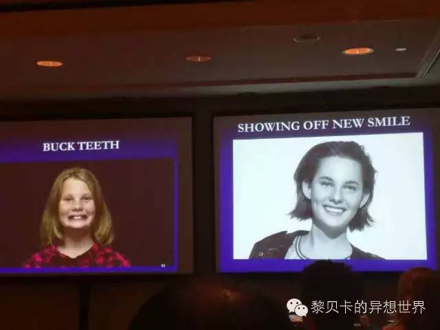 她们说||那些年整牙吞下的血和泪,终于换来最开怀的大笑