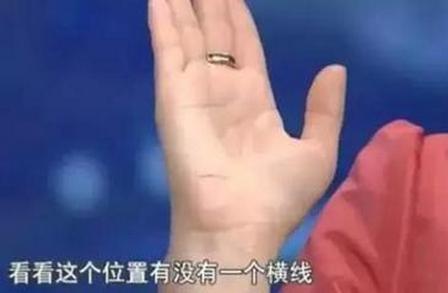 手指盖有竖黑线截肢,手上突然出现凹凸横纹