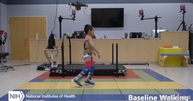 脑瘫儿最好的恢复情况,现在都是怎么处理脑瘫儿的