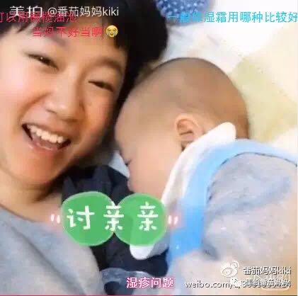 婴儿湿疹头垢洗了之后一直在出水,新生儿头垢和湿疹结痂的区别