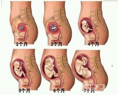 怀孕4个月没感觉到胎动正常吗,我怀孕快4个月了胎儿没动