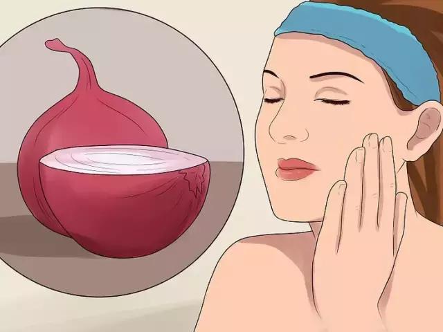 激光美容后脸上黑点多久能消除,消除脸上黑点吃什么药