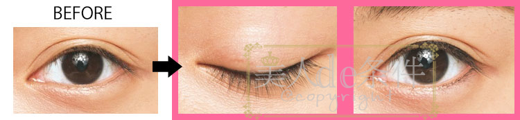 内双肿眼泡怎么不贴双眼皮画眼妆,一个单眼皮一个双眼皮怎么化眼妆