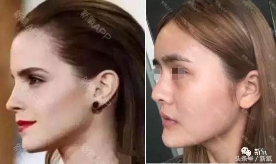 杨紫微整前后容颜对比,杨紫瘦了吗