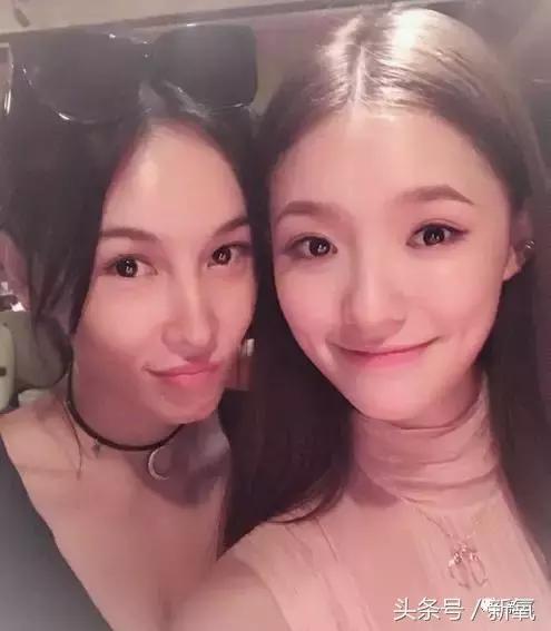 杨紫微整前后容颜对比,杨紫瘦了吗