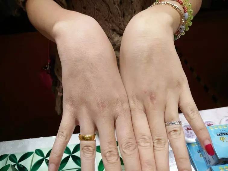 八旬老人东北亚博览会卖曾老爹金门一条根受到市民称赞