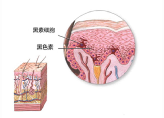 肌肤美白最佳方案,关于肌肤美白有哪些小常识