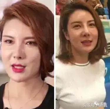 杨紫微整前后容颜对比,杨紫瘦了吗
