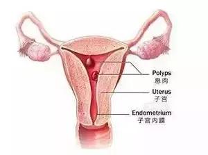 多年不孕的因果,多年不孕不育竟是妻子惹的祸